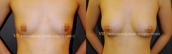 	Breast Surgery, Body Contouring	 - Breast surgery
