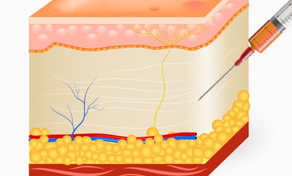 Steps for Breast Fat Grafting Surgery Method