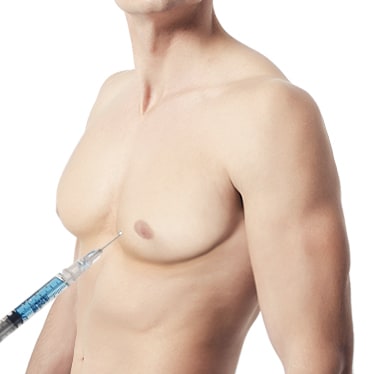 Liposuction Method of Male Breast Reduction
