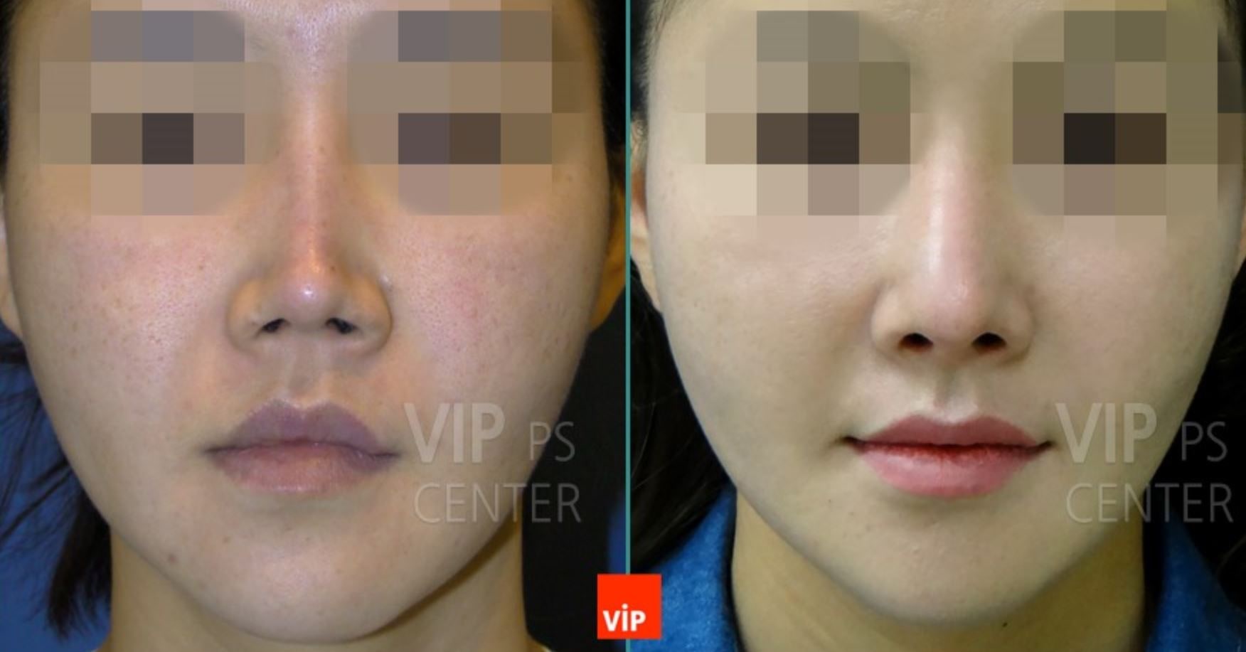 Theunissen aesthetic plastic surgery of baton rouge photos