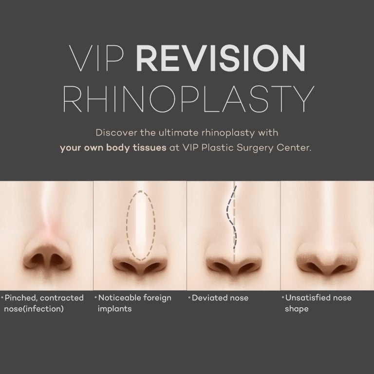 VIP Revision Rhinoplasty Surgery