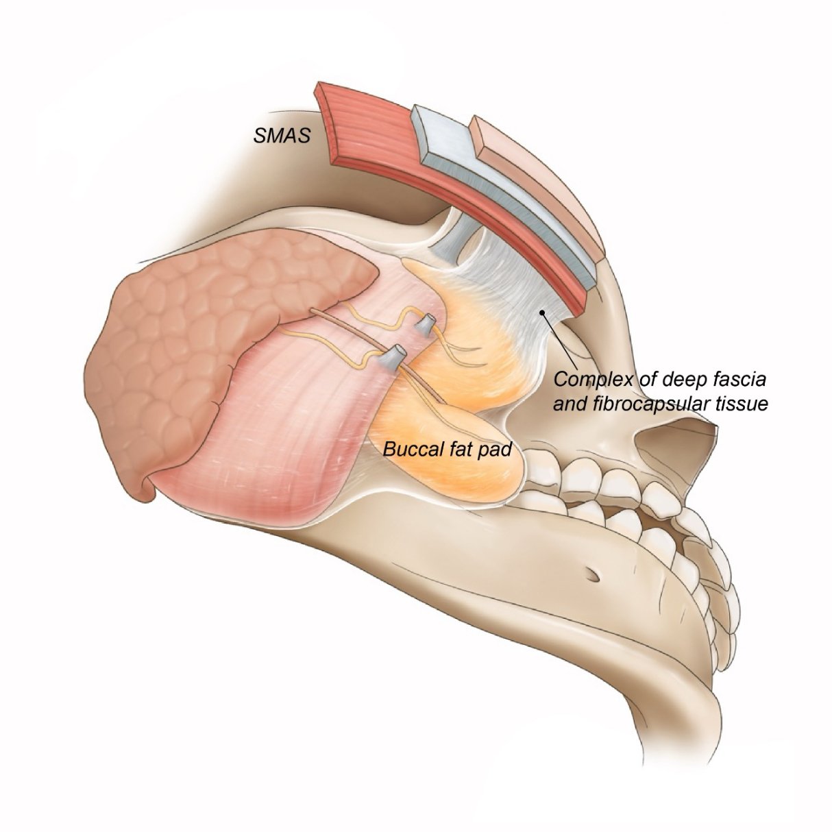For patients with these distinctive features