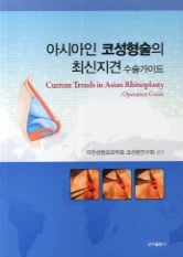 Asian Rhinoplasty Surgical Guide