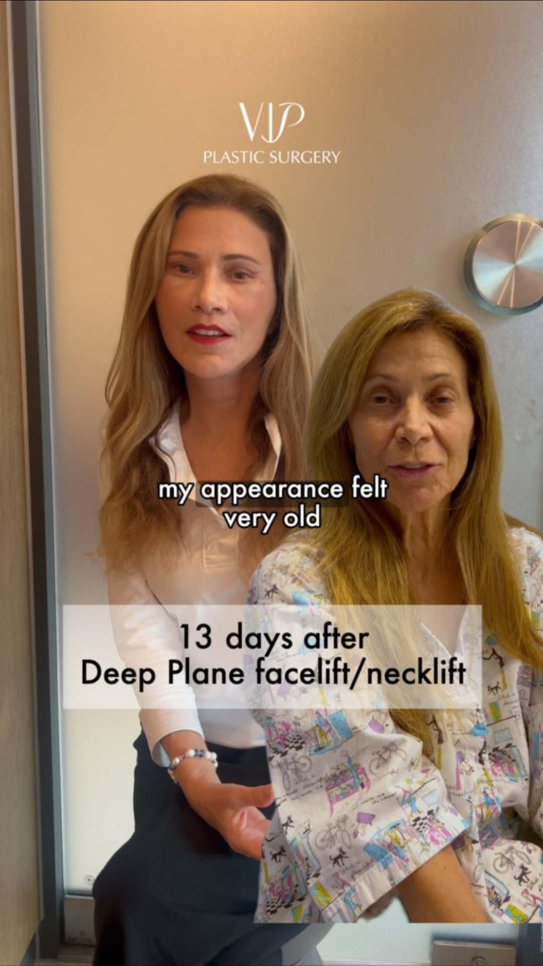 2 Weeks Post-op Female Extended Deep Plane Facelift and Necklift Video