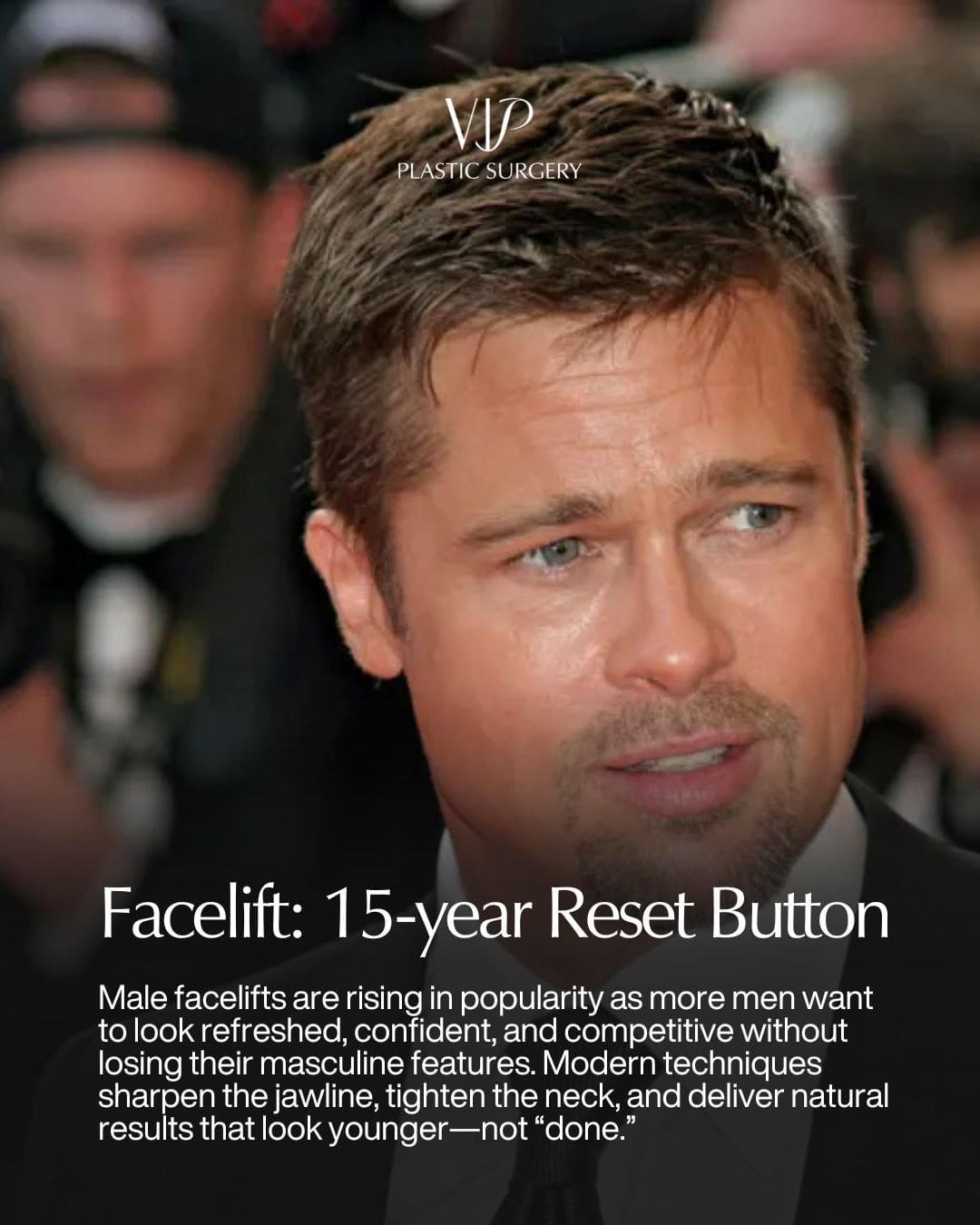 Facelift For Men In South Korea
